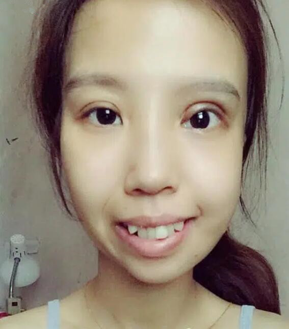 女子因嘴歪被丈夫抛弃,如今做数次整容变漂亮,前夫后悔不已