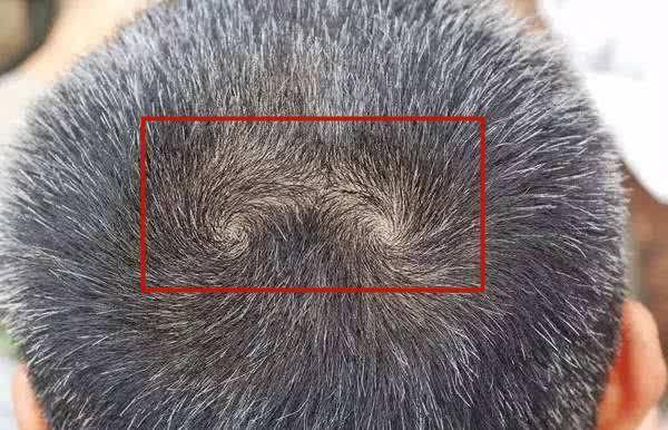 前不久,听说了"双旋男孩找不到,双旋女孩没人要"的俗语,孩子头上的旋