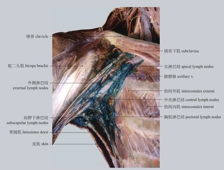 vessels and nodes of upper limb图6-65 上肢浅淋巴管和淋巴结前面观