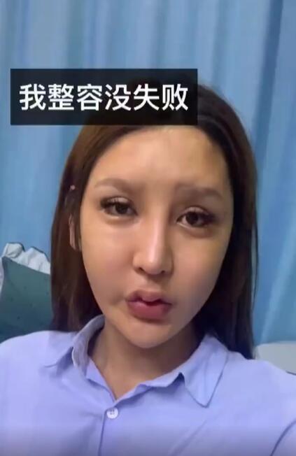 女网红出现整容后遗症被骂怪物眼睛疯狂抽搐却口口声声说整容没失败