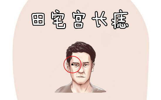 身上有5颗"福禄"痣,祖上有钱,手握财库,个个皇帝命福气大!