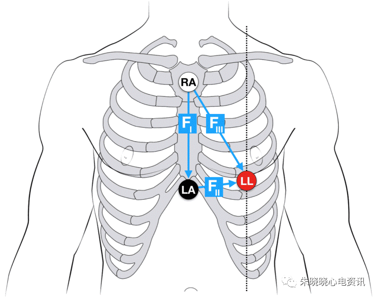 多种不同的心电导联接法,你掌握了吗?