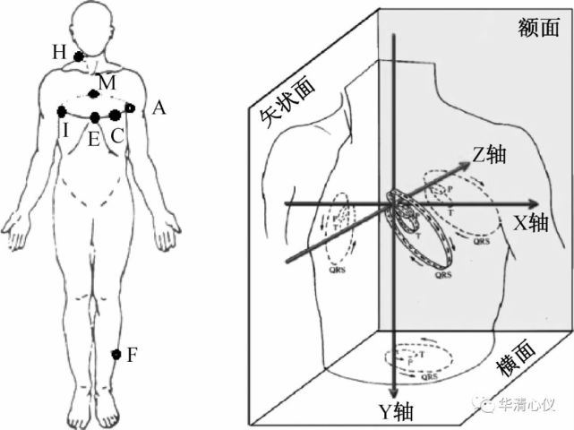 该系统需要7个电极,其中5个应用在第五肋间与胸骨左缘交叉的水平面