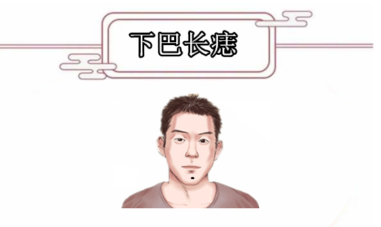 下巴长痣