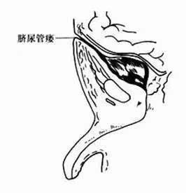 人的肚脐眼因为位置比较深,再加上形成方式的不同,奇特的形状导致难