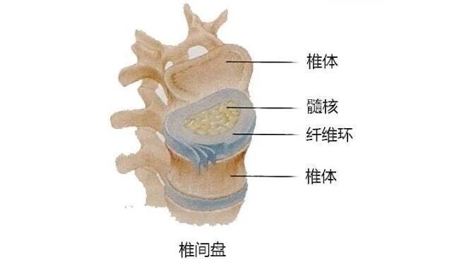 对于腰间盘突出,真正的原因你知道几个?