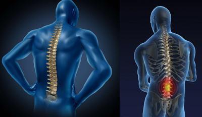 强直性脊柱炎为什么会累及颈椎