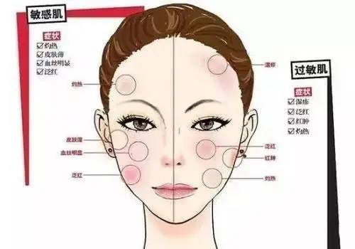 面部皮肤过敏怎么办 你需要知道这些.
