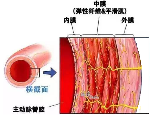 主动脉夹层常见问题