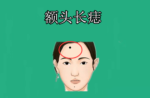 额头长痣额头即天庭,代表的是一个人的上等面相与个人的财运等,通常的