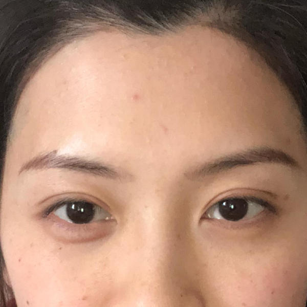 5,肤色暗沉