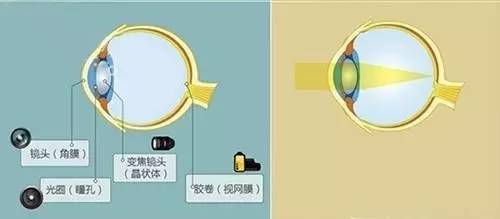 新视力自然疗愈科普:散光是怎么回事,有了散光该怎么办呢?