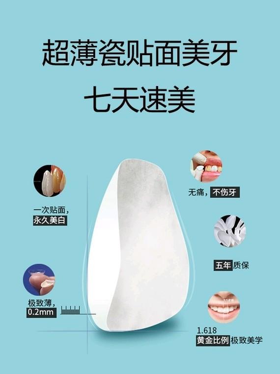 什么是牙齿美白瓷贴面呢