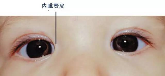 婴儿的眼睛健康需要注意哪些?