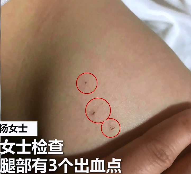 西安一3岁女童幼儿园被虐待,全身共29处针眼,校方电话关机_腾讯新闻