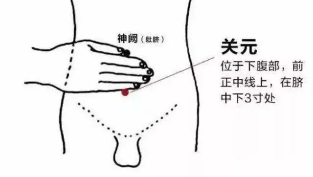 除拔上述主穴外,还可加中脘穴,关元穴,丰隆穴 关元穴(位置:肚脐正