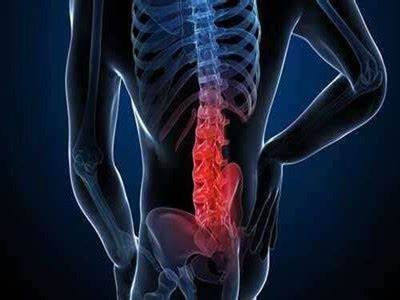 我怎么患上了强直性脊柱炎?难道是最近摔伤了腰,不一定是这样.