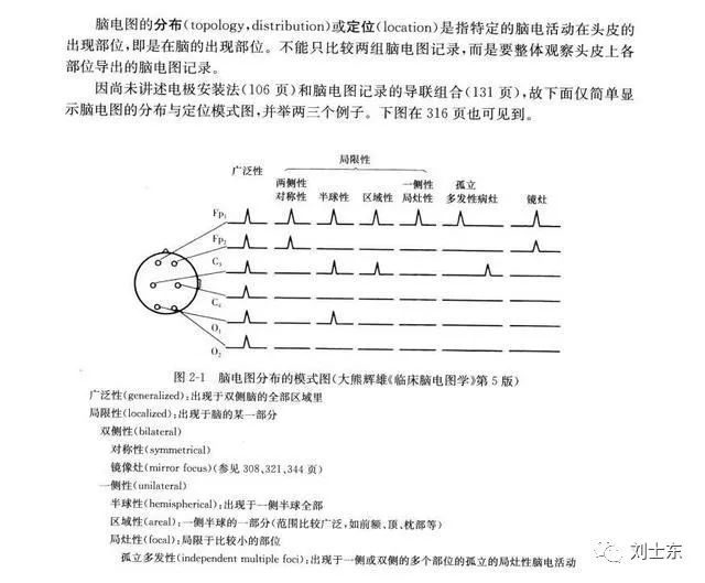 脑电图基础知识科普(简单易懂)