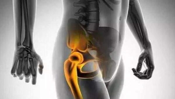 一,股骨大转子疼痛综合征 臀部周围的肌肉称为臀肌.
