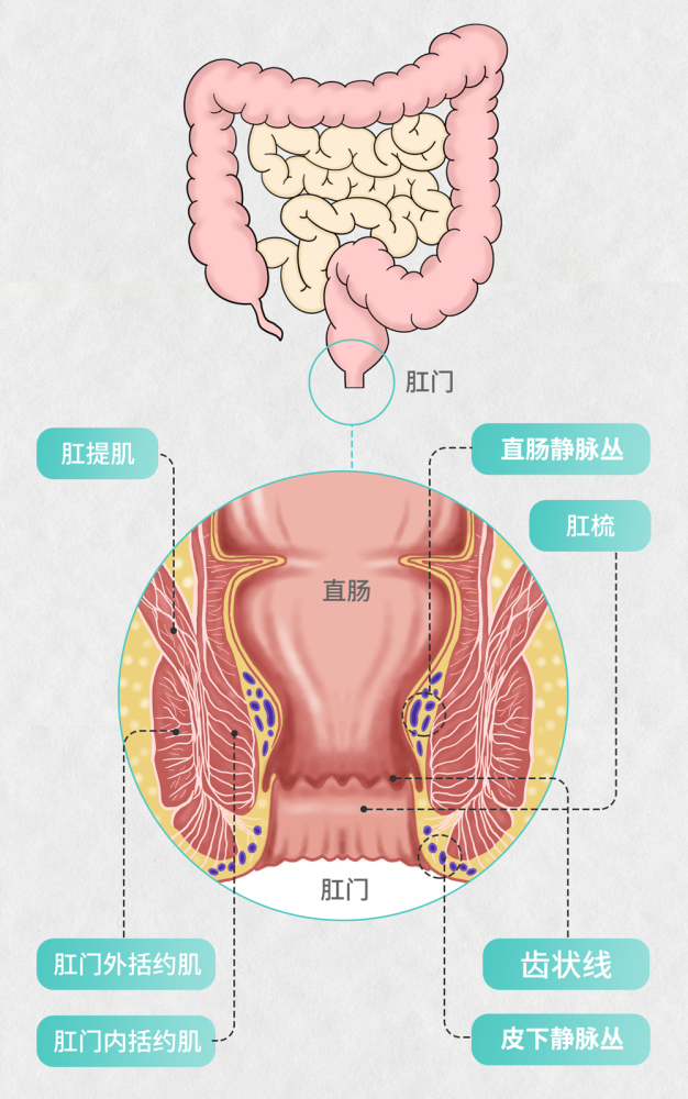 一下生活中非常常见的一种肛肠疾病-痔疮,常言道,十男九痔,十女十痔