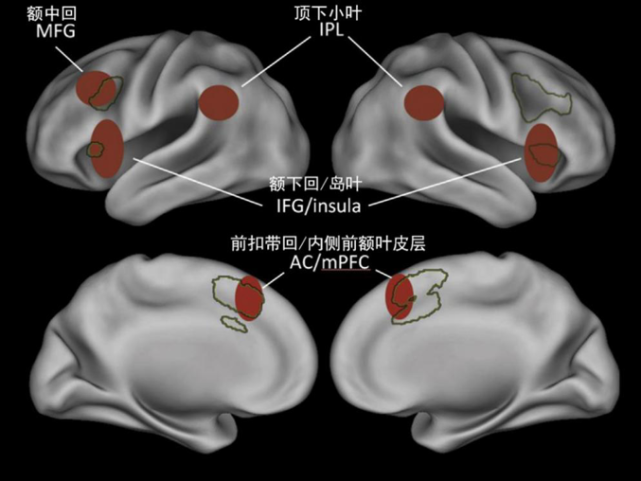 位于额顶叶的部分脑区表现出更强的神经活动,如前扣带回皮层(anterior