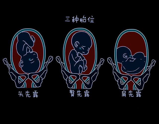 怀孕28周去产检,这3个问题,就算医生不提及,孕妇也要记得问