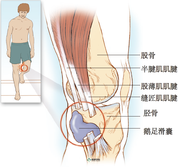疼痛解剖学|鹅足滑囊炎