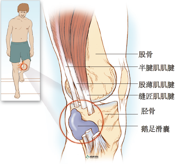 疼痛解剖学鹅足滑囊炎