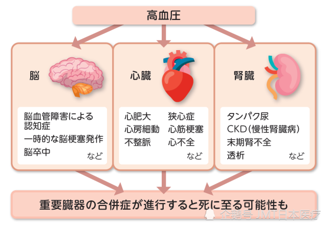 伴随高血压可能产生的并发症