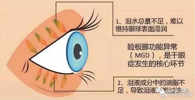 备受折磨,头晕眼花,眼疼干涩流泪怎么办?