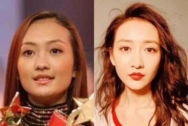 王鸥疑似显露整容后遗症,腮帮时大时小,脸型畸形被吐槽像芒果