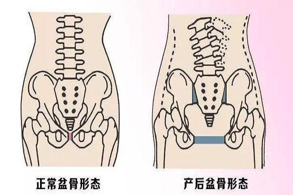 没生过孩子的女性,宫口没有经过扩张,所以宫口是一个小孔型,形状很