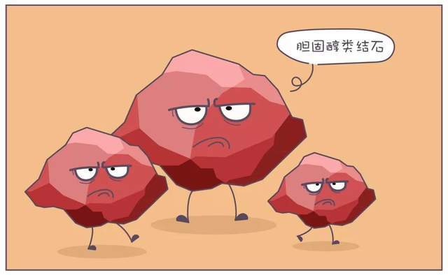 结石,从来就不是突然出现的!_腾讯新闻