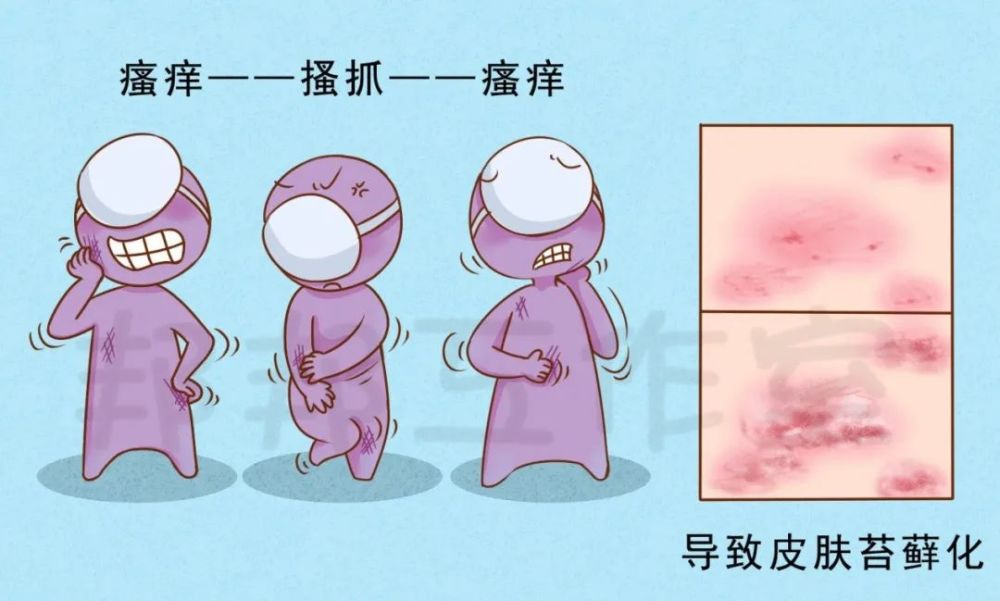 晚上睡不着,皮肤痒痒痒,神经性皮炎该怎么办?