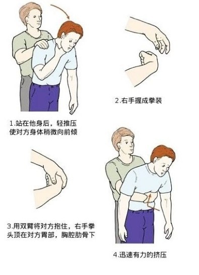 成人海姆立克急救法自我解救应用于无意识病人4 八项注意,预防儿童