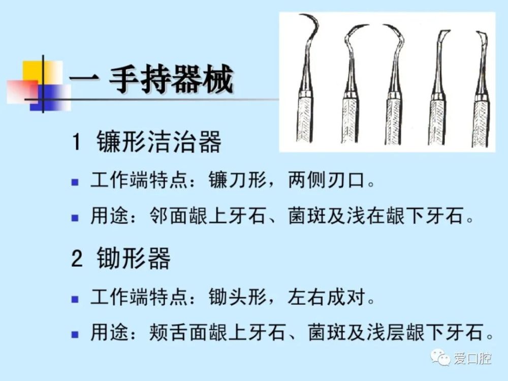 龈上洁治术的操作方法