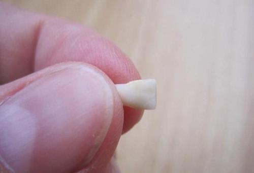 乳牙掉了别急着扔,关键时刻能救命?事情并不简单,家长