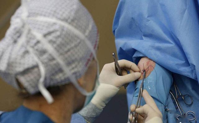 同样是被"划一刀",侧切和剖腹产这7个方面区别大,你很难想到