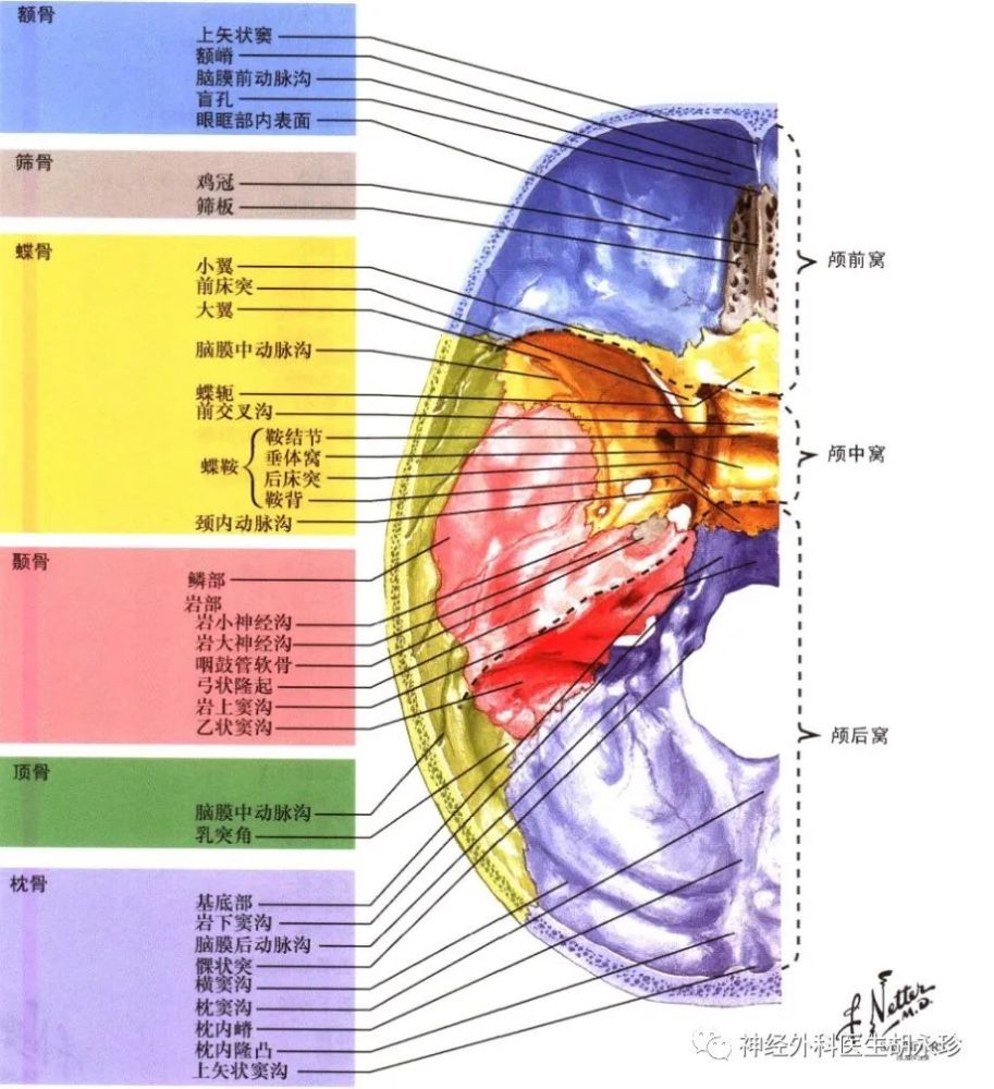 中颅底骨折是神经外科常见的疾病,指因外力挤压头部导致颅骨发生变形