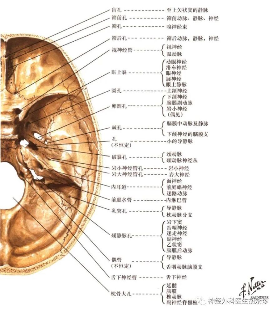 中颅底骨折是神经外科常见的疾病,指因外力挤压头部导致颅骨发生变形