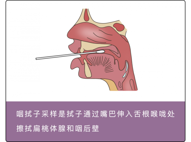 核酸检测为啥要戳菊花啊!