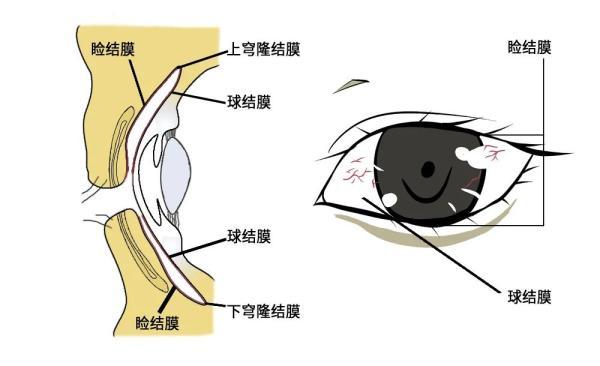 睑结膜是眼睑最内面的一层,球结膜贴附在眼球前,睑结膜,球结膜相互