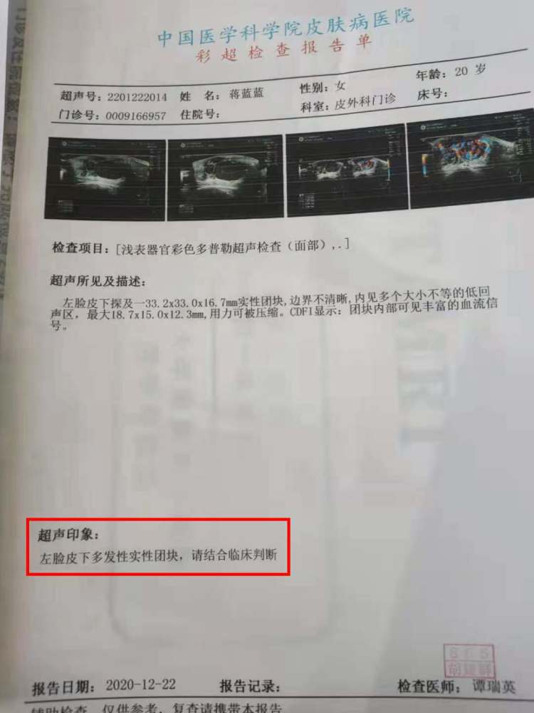 巢湖市21岁的我被黑色素瘤缠身,我希望能活下来,帮父母亲经营好这个家
