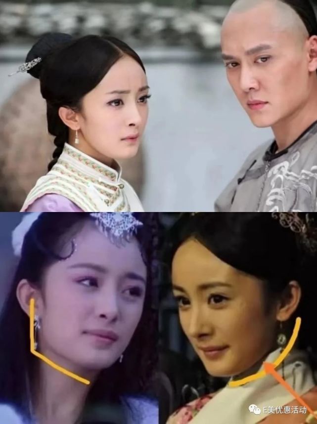 第一步很明显是削骨,这个在《宫》阶段很明显就能看出来,下颌骨消失后