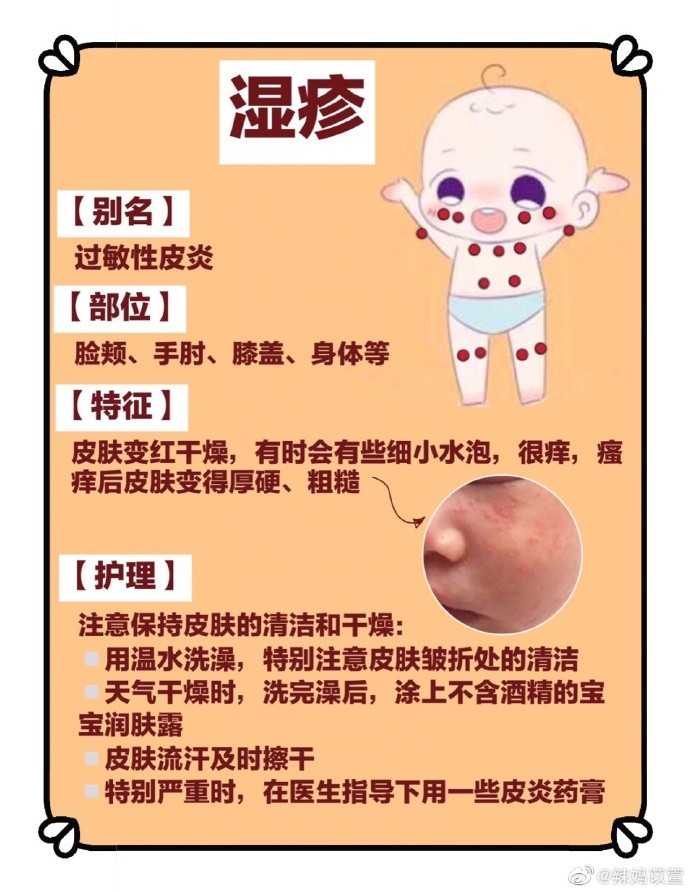 宝宝湿疹皮炎的特征及护理