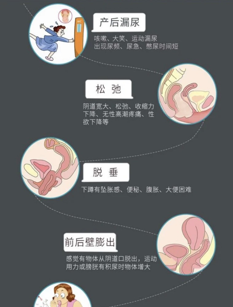 产后盆底肌紧致其实只需要简单的4招!