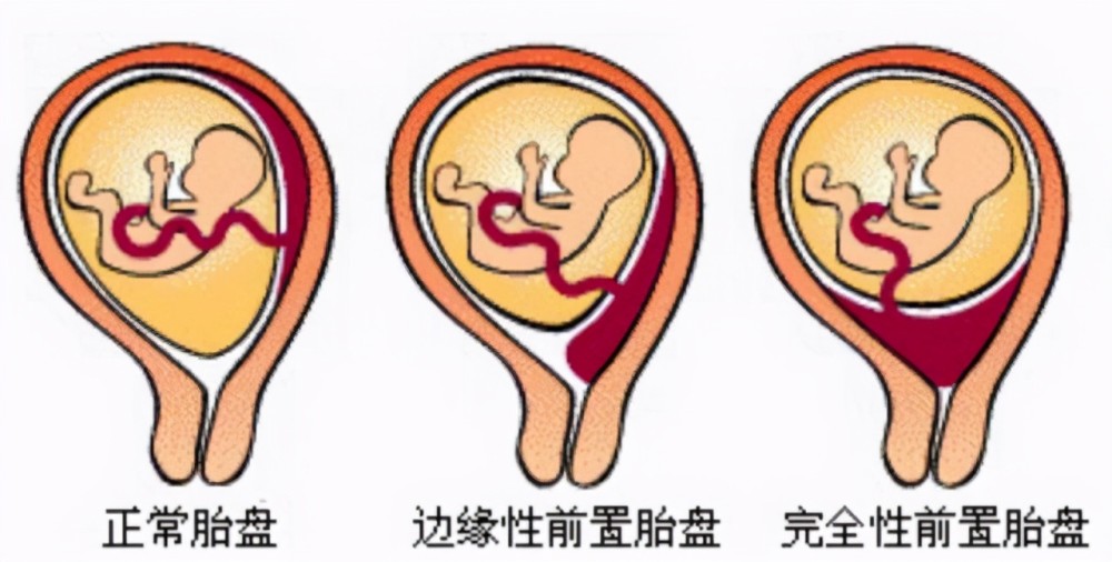 这5点是