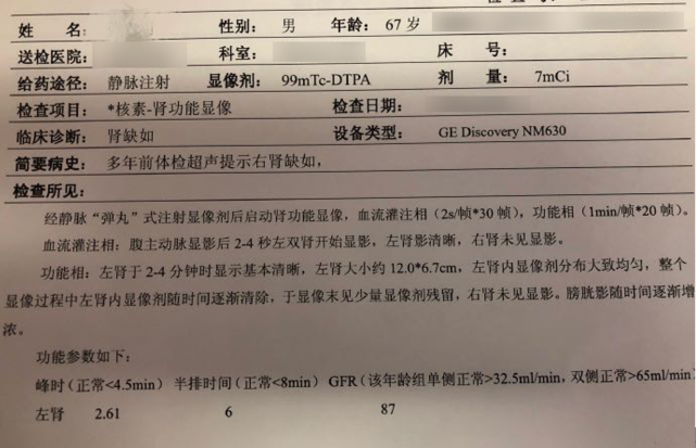 腰酸脚痛,是因为天生只有一个肾?