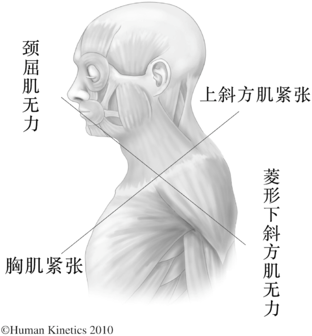 很多人生活中不注意体态,长时间驼背和头前伸,再加上背部的肌群又不够