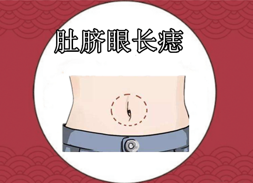 肚脐眼长痣